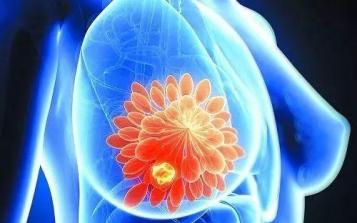 研究稱抗氧化食物可降低患乳腺癌風(fēng)險(xiǎn)，女性25歲后每年檢查