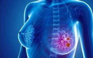 新冠肺炎疫情期間，乳腺癌患者如何治療與預(yù)防？