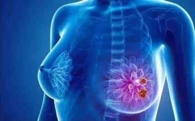 新冠肺炎疫情期間，乳腺癌患者如何治療與預(yù)防？