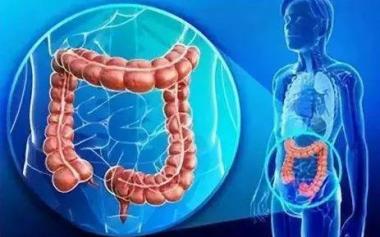 全球大腸癌日益年輕化！小心了，9成大腸癌源于息肉癌變！